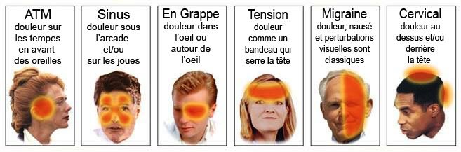 Patchs Rafraîchissants Pour Front – Réutilisables – Soulagement Maux De Tête, Fatigue, Coup De Chaleur